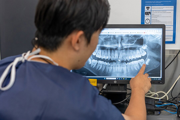 A man examines a dental x-ray displayed on a computer screen, focusing intently on the details.